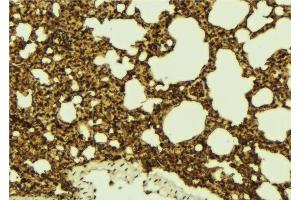 ABIN6273294 at 1/100 staining Mouse lung tissue by IHC-P.