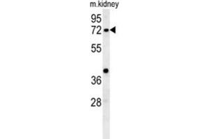 Western Blotting (WB) image for anti-Kelch-Like 6 (KLHL6) antibody (ABIN3002443) (KLHL6 anticorps)