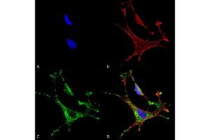 Immunocytochemistry/Immunofluorescence analysis using Mouse Anti-MMP9 Monoclonal Antibody, Clone S51-82 (ABIN2482807).