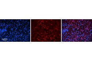 Rabbit Anti-ZNF419 Antibody      Formalin Fixed Paraffin Embedded Tissue: Human Adult Liver   Observed Staining: Nuclear in hepatocytes, strong signal, wide tissue distribution  Primary Antibody Concentration: 1:100  Secondary Antibody: Donkey anti-Rabbit-Cy3  Secondary Antibody Concentration: 1:200  Magnification: 20X  Exposure Time: 0.