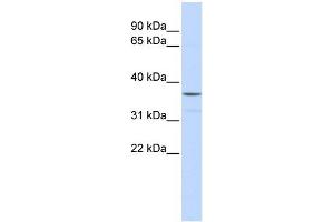 WB Suggested Anti-ZNF787 Antibody Titration:  0. (ZNF787 anticorps  (Middle Region))
