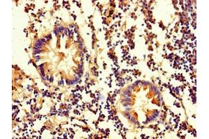 Immunohistochemistry of paraffin-embedded human appendix tissue using ABIN7162111 at dilution of 1:100 (OLA1 anticorps  (AA 1-396))