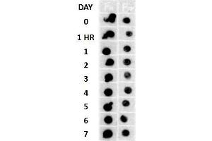 Dot blot analysis using Rabbit Anti-Amyloid Fibrils (OC) Polyclonal Antibody . (Amyloid anticorps (Biotin))