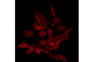 ABIN6266473 staining HuvEc by IF/ICC.