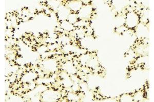 ABIN6272912 at 1/100 staining Mouse lung tissue by IHC-P.