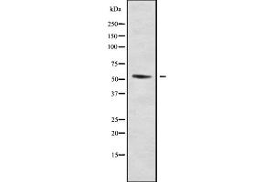 Western blot analysis of DMRTA1 using HT-29 whole cell lysates (DMRTA1 anticorps  (Internal Region))