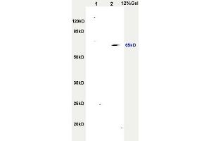 L1 rat heart, L2 rat brain lysates probed (ABIN749258) at 1:200 in 4 °C.