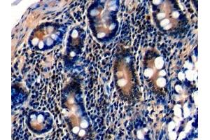 Detection of Ki-67 in Human Small intestine Tissue using Polyclonal Antibody to Ki-67 Protein (Ki-67) (Ki-67 anticorps  (AA 2815-2928))