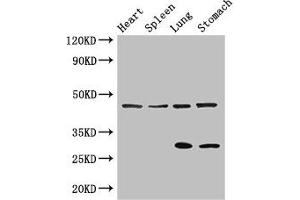 Western Blot Positive WB detected in: Mouse heart tissue, Mouse spleen tissue, Mouse lung tissue, Mouse stomach tissue All lanes: REN antibody at 3 μg/mL Secondary Goat polyclonal to rabbit IgG at 1/50000 dilution Predicted band size: 46, 45 kDa Observed band size: 46, 29 kDa (Renin anticorps  (AA 229-398))