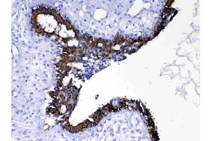 IHC analysis of Cytokeratin 8 using anti- Cytokeratin 8 antibody .