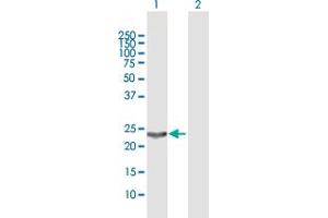 Western Blot analysis of PGDS expression in transfected 293T cell line by PGDS MaxPab polyclonal antibody.