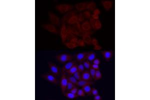 Immunofluorescence analysis of HeLa using Vinculin Rabbit mAb (ABIN3016604, ABIN3016605, ABIN1680530 and ABIN1680531) at dilution of 1:100 (40x lens). (Vinculin anticorps)