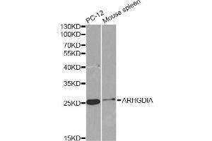 Western blot analysis of extracts of various cell lines, using ARHGDIA antibody (ABIN6291256) at 1:1000 dilution. (ARHGDIA anticorps)