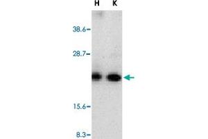 Western blot analysis of CRADD in whole cell lysates from HeLa (H) or K-562 (K) cells with CRADD polyclonal antibody  at 1 : 500 dilution. (CRADD anticorps  (AA 99-117))