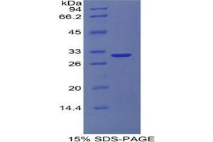 SDS-PAGE analysis of Human COL4A1 Protein. (COL4A1 Protéine)