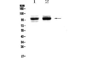 Western blot analysis of SATB1 using anti-SATB1 antibody . (SATB1 anticorps  (AA 638-763))