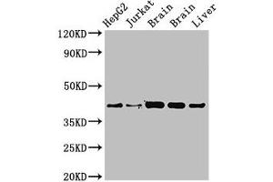 Western Blot Positive WB detected in: HepG2 whole cell lysat, Jurkat whole cell lysate, Rat brain tissue, Mouse brain tissue, Mouse liver tissue All lanes: IDH3A antibody at 3. (IDH3A anticorps  (AA 28-108))