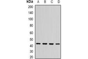 Western blot analysis of ST3GAL5 expression in BT474 (A), SHSY5Y (B), mouse brain (C), rat brain (D) whole cell lysates. (ST3GAL5 anticorps)