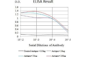 Black line: Control Antigen (100 ng),Purple line: Antigen (10 ng), Blue line: Antigen (50 ng), Red line:Antigen (100 ng)