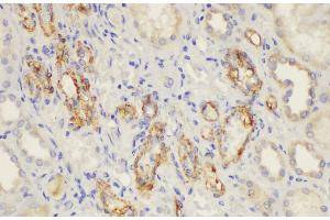 Immunohistochemistry of paraffin-embedded Human kidney using CD146 Ployclonal Antibody at dilution of 1:50. (MCAM anticorps)
