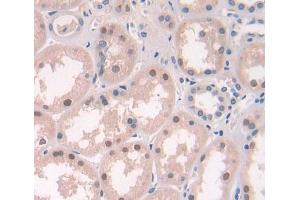 Used in DAB staining on fromalin fixed paraffin- embedded Kidney tissue (ERCC2 anticorps  (AA 404-637))