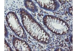 Immunohistochemical staining of paraffin-embedded Human colon tissue using anti-ACBD3 mouse monoclonal antibody.