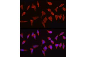 Immunofluorescence analysis of HeLa cells using Bcl-2 Mouse mAb (ABIN7265809) at dilution of 1:100 (40x lens). (Bcl-2 anticorps)