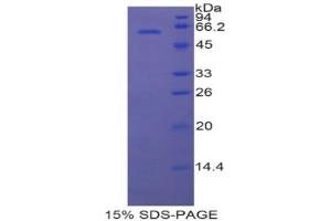 SDS-PAGE analysis of Rat HSD17b12 Protein.