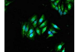 anti-Galactosidase, beta 1 (GLB1) (AA 317-455) antibody