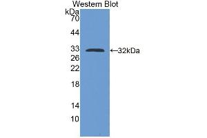 Western blot analysis of the recombinant protein. (Kallikrein 13 anticorps  (AA 22-277))