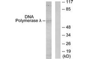 Western blot analysis of extracts from 293 cells, using DNA Polymerase lambda Antibody. (POLL anticorps  (AA 451-500))