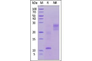Biotinylated Human TSLP, His,Avitag on  under reducing (R) and ing (NR) conditions.