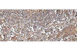 Immunohistochemistry of paraffin-embedded Human tonsil using VSIG8 Polyclonal Antibody at dilution of 1/30