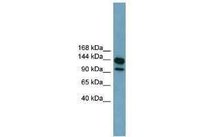 WB Suggested Anti-LRRC66 Antibody Titration:  0. (LRRC66 anticorps  (Middle Region))