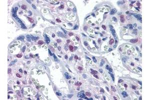 Immunohistochemistry (IHC) image for anti-serine/threonine Kinase 17a (STK17A) (AA 301-414) antibody (ABIN614691)