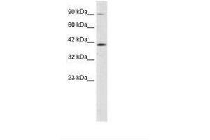 Image no. 1 for anti-Zinc Finger Protein 830 (ZNF830) (AA 240-289) antibody (ABIN202361)