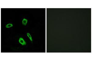Immunofluorescence analysis of LOVO cells, using EDG7 antibody. (LPAR3 anticorps  (Internal Region))