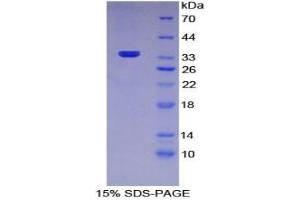SDS-PAGE analysis of Mouse MRC1 Protein. (Macrophage Mannose Receptor 1 Protéine)