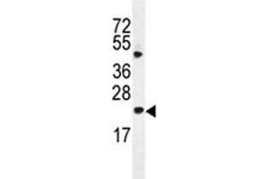 Bax antibody western blot analysis in HL-60 lysate (BAX anticorps  (AA 41-76))