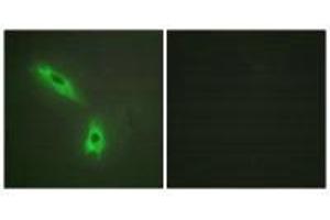 Immunofluorescence analysis of HeLa cells, using TNFC antibody. (LTB anticorps  (C-Term))
