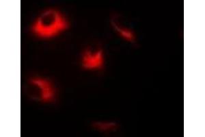 Immunofluorescent analysis of Dopamine Receptor D5 staining in Hela cells. (DRD5 anticorps)