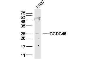 Lane 1: U937 lysates probed with CCDC46 Polyclonal Antibody, Unconjugated  at 1:300 overnight at 4˚C. (CCDC46 anticorps  (AA 751-850))