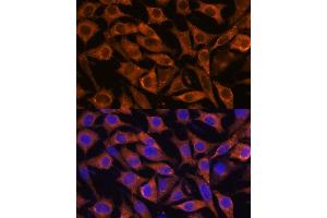 Immunofluorescence analysis of L929 cells using [KO] IFITM3 antibody (ABIN6130482, ABIN6142186, ABIN6142187 and ABIN7101416) at dilution of 1:100. (IFITM3 anticorps  (AA 1-133))