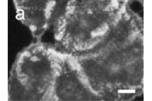 Image no. 1 for anti-Collagen, Type XVII, alpha 1 (COL17A1) (AA 507-548), (Chain alpha 1) antibody (ABIN191526)