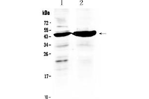 Western blot analysis of TFPI using anti- TFPI antibody . (TFPI anticorps  (AA 253-304))