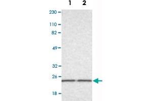 Western Blot analysis of Lane 1: RT-4 and Lane 2: U-251MG sp cell lysates with RAB13 polyclonal antibody . (RAB13 anticorps)