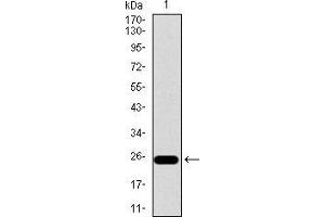 Western blot analysis using ITGB4 mAb against human ITGB4 recombinant protein. (Integrin beta 4 anticorps  (AA 1619-1822))