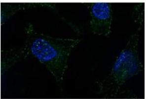 Sample Type: subnuclear bodies-paraspeckles (NONO anticorps  (N-Term))