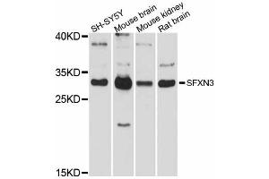 Western blot analysis of extracts of various cell lines, using SFXN3 antibody (ABIN5998794) at 1/1000 dilution.