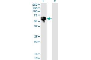 Western Blot analysis of BLK expression in transfected 293T cell line by BLK monoclonal antibody (M02), clone 7A12.